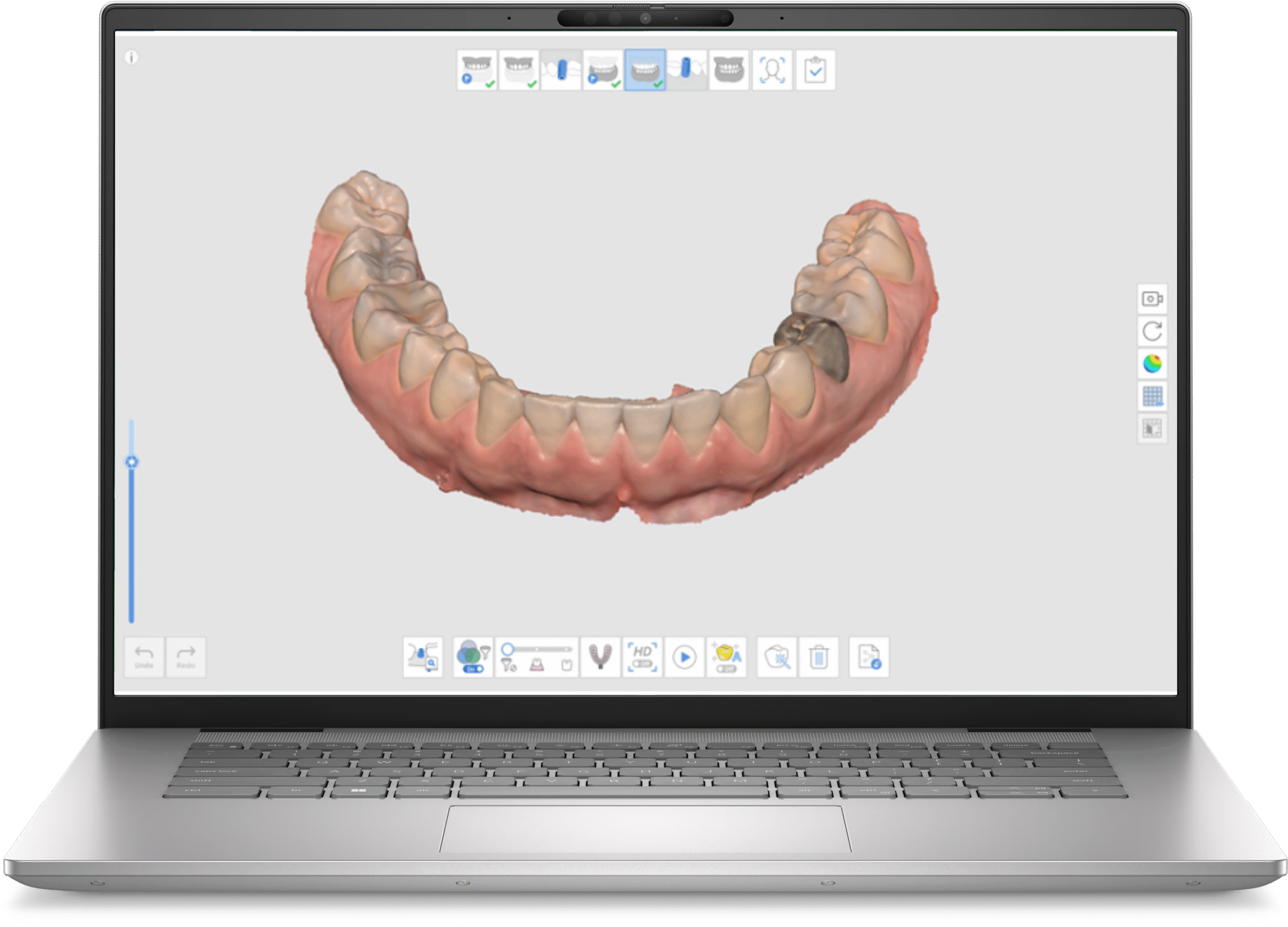 Medit i700 Wired Intraoral Scanner Package - Scanner, Trolley and Laptop - Image 6