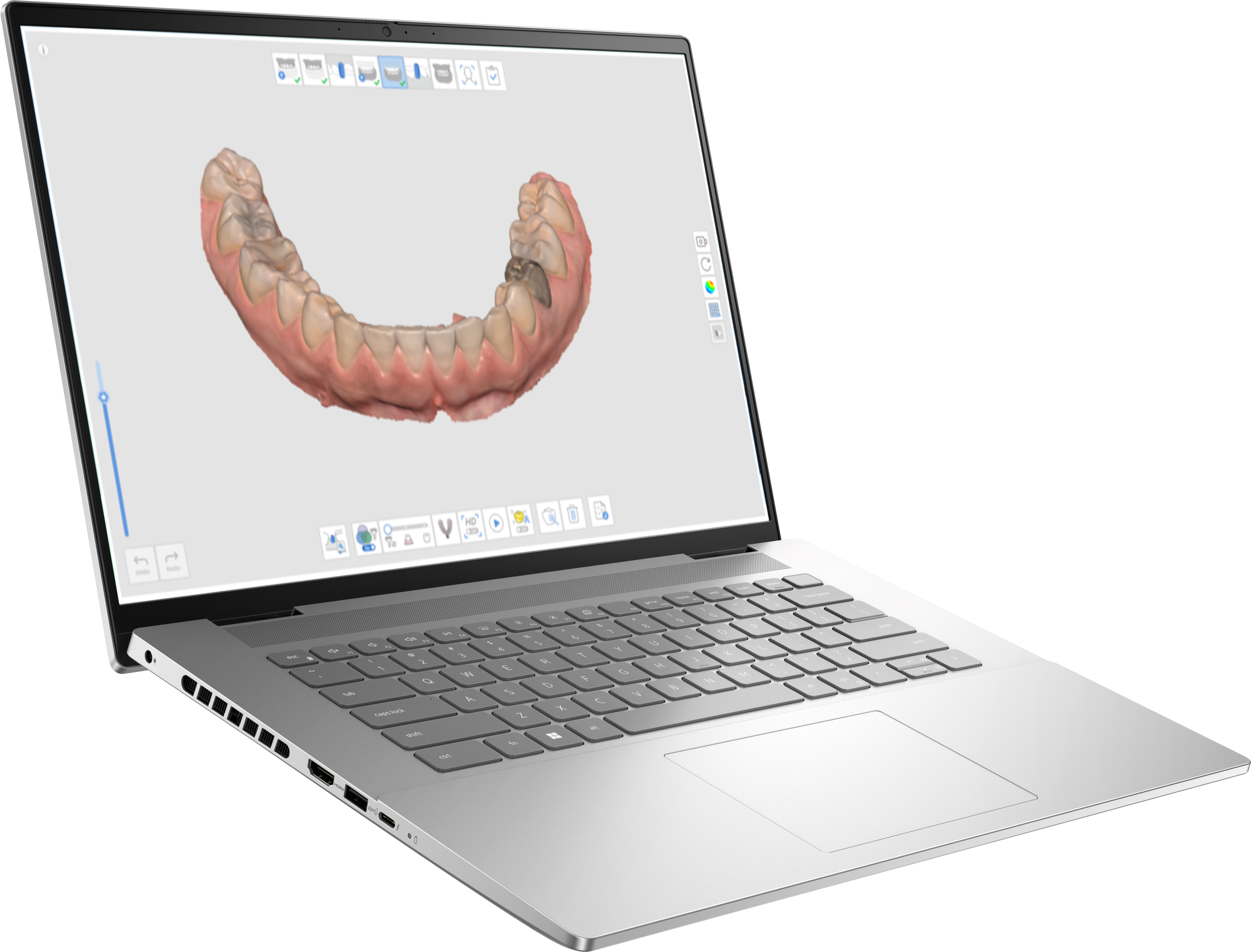 Medit i700 Wired Intraoral Scanner Package - Scanner, Trolley and Laptop - Image 4